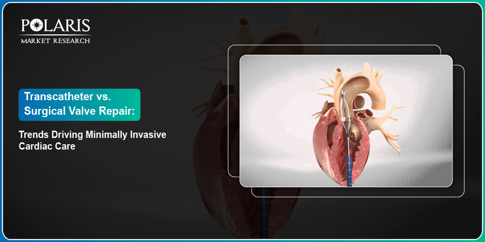 Transcatheter vs. Surgical Valve Repair: Trends Driving Minimally Invasive Cardiac Care